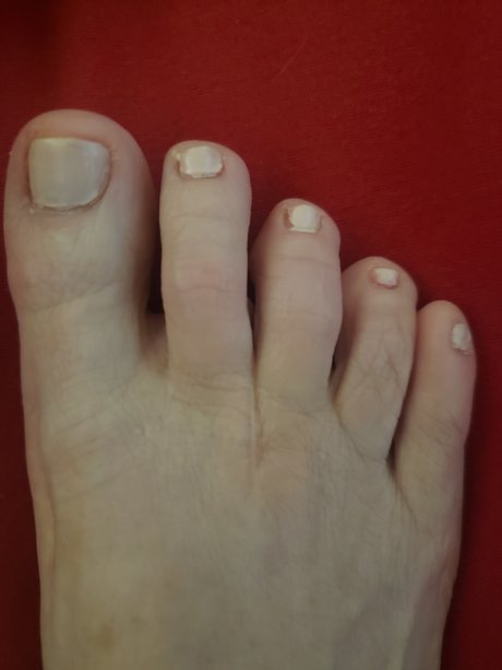Sweetfeet