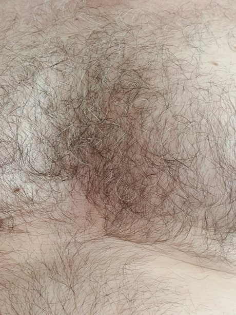 Naken lekkede OnlyFans-bilde av Harry Mann