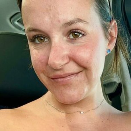 Sunburnsugar