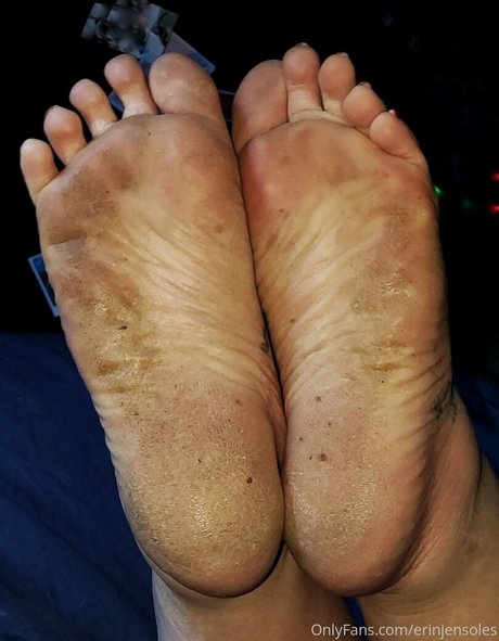 Erinjensoles