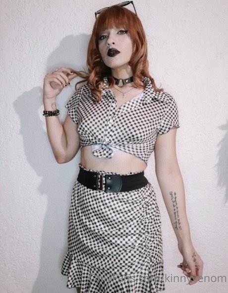 Kinnyvenom