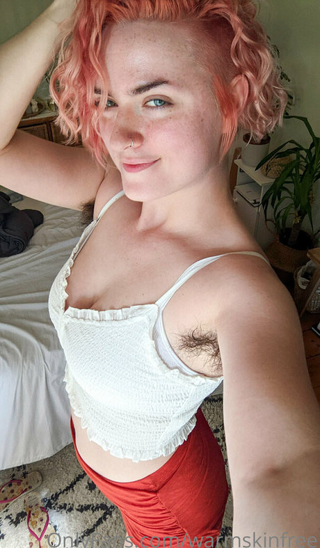 Warmskinfree