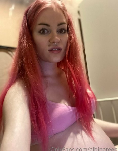 Alasti lekkinud OnlyFans-i pilt Albinoteen