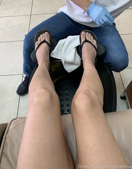 Realgarnetrose