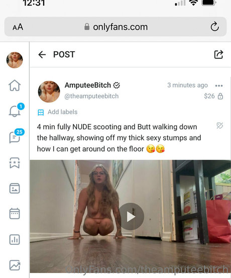 Theamputeebitch