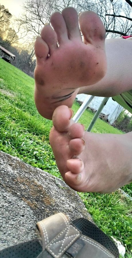 Missfeetstink