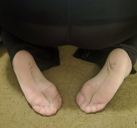 Missfeetstink