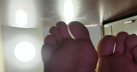 Missfeetstink