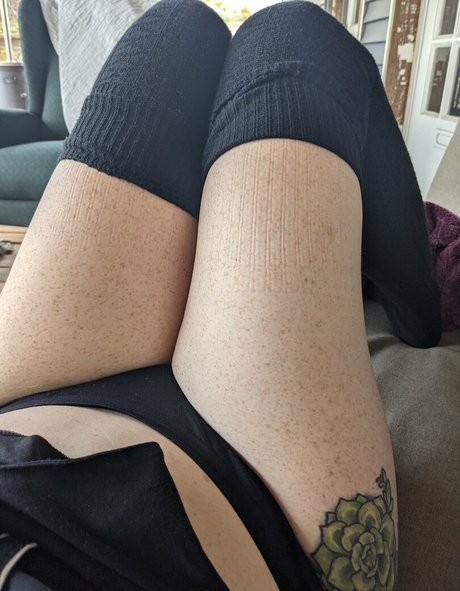 Frecksfordays