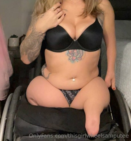 Thisgirlwheelsamputee